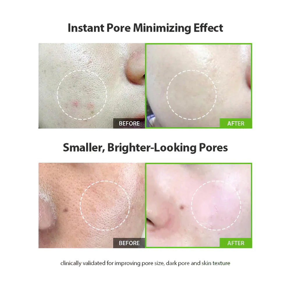 Green Tomato Pore Lifting Ampoule