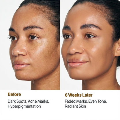 Kojic Acid Niacinamide Facial Cleanser